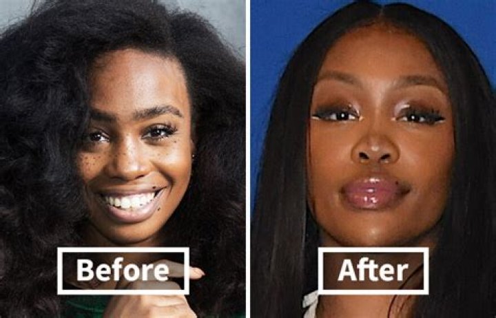 Unveiling The Untold Truths: SZA Before Surgery